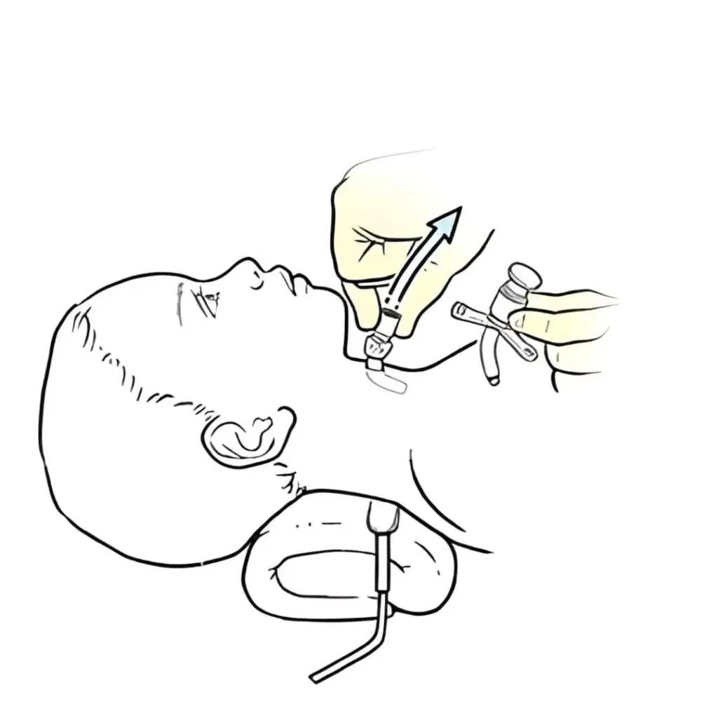 ChangeTracheostomy tube change nursing procedure at home in Ranchi