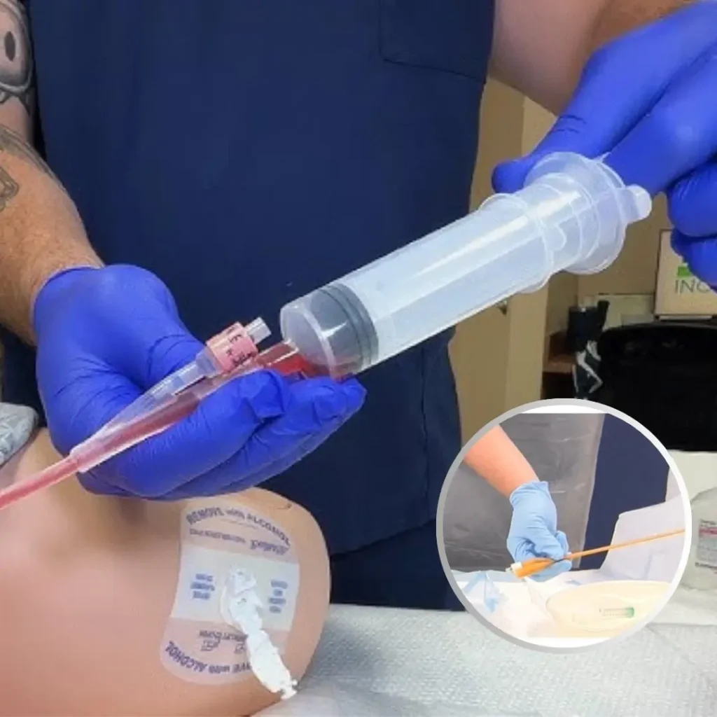 Bladder wash nursing procedure at home in Ranchi