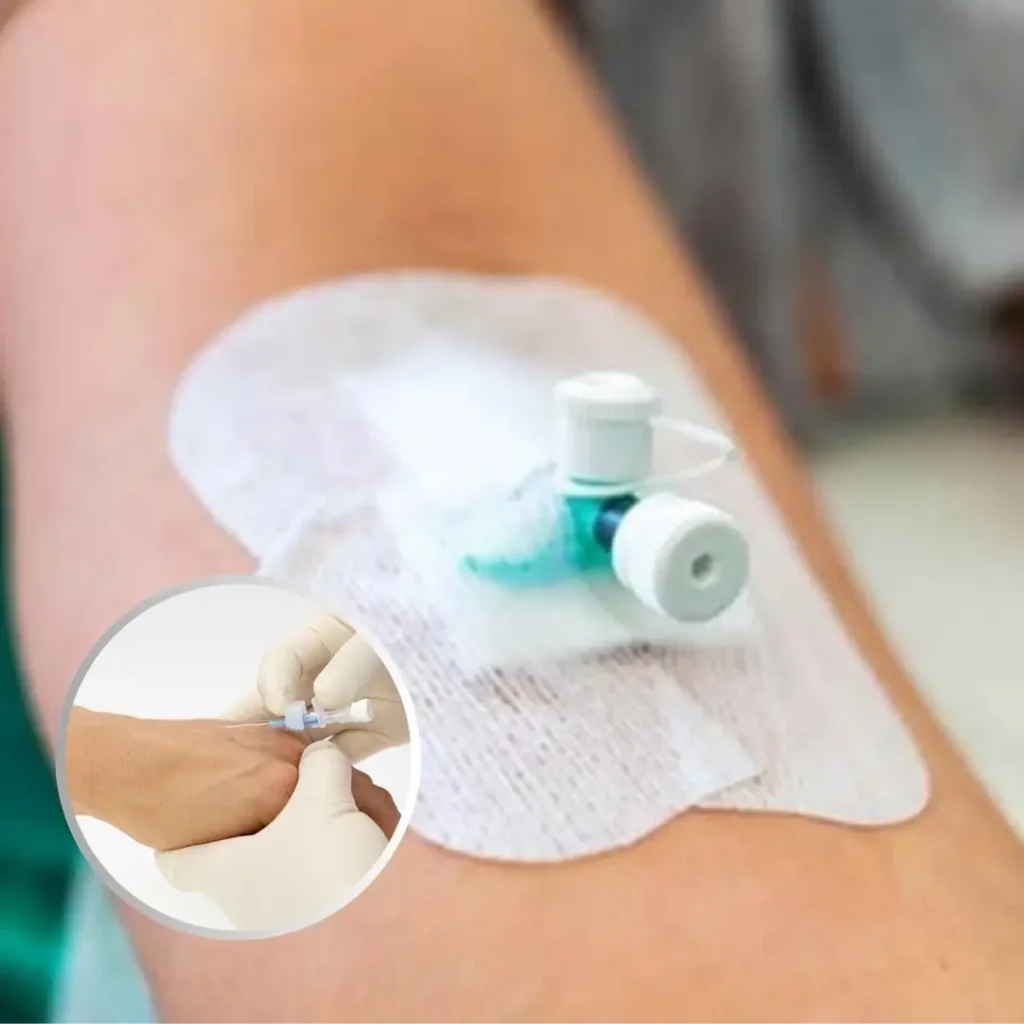 IV cannula insertion nursing procedure at home in Ranchi